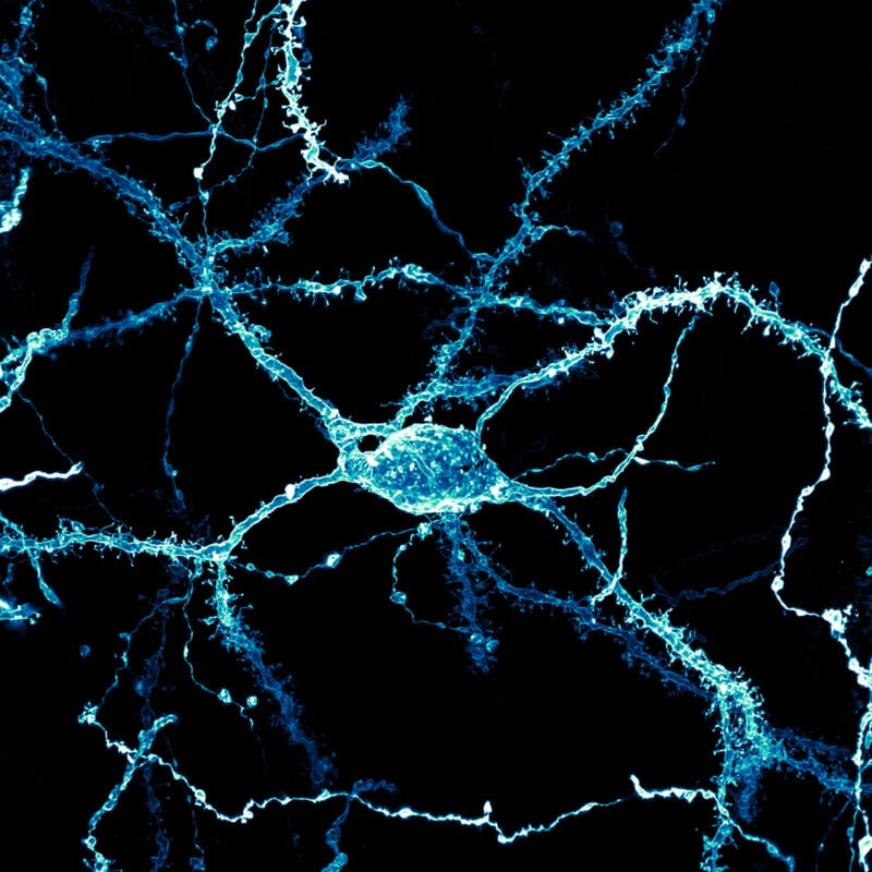 Microscopic image of a neuron with a central cell body and radiating dendrites, depicted in glowing blue against a dark background, highlighting the intricate network of neural connections.