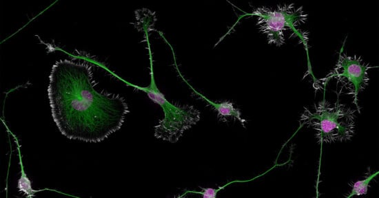 Microscopic image of six neurons with green axons and dendrites, pink cell bodies, and black background. Neurons display complex interconnections and branch-like structures, resembling a network.