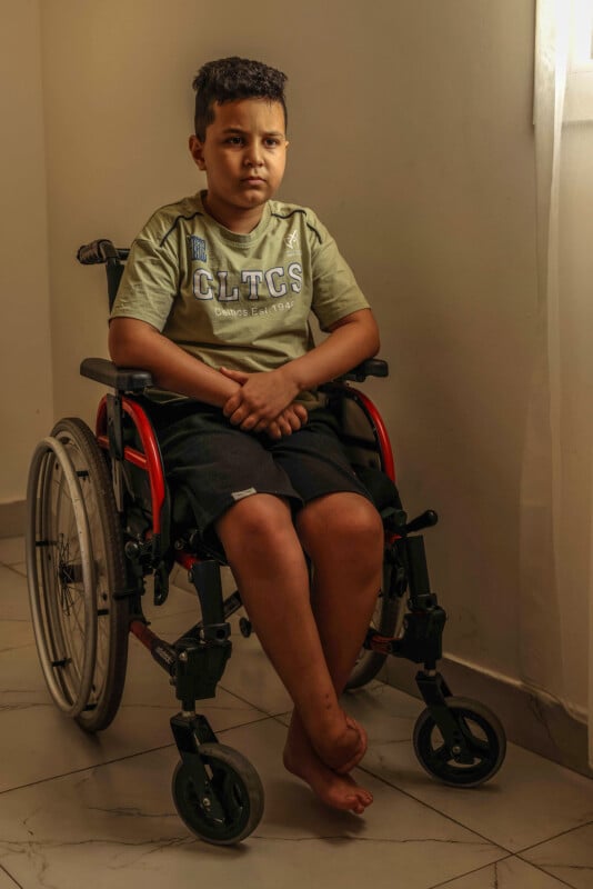 A young boy sits in a wheelchair by a window, wearing a light green shirt and black shorts. He looks ahead with a thoughtful expression, hands clasped in his lap, and bare feet resting on the footrests. The room is softly lit.