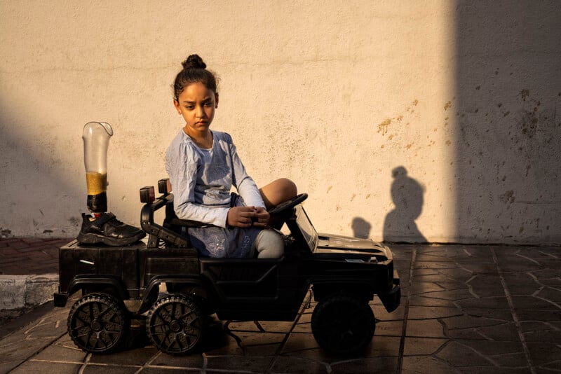 A young girl with an artificial leg sits in a toy car on a tiled surface, illuminated by warm sunlight. Her expression is contemplative, and a shadow is cast on the wall behind her.