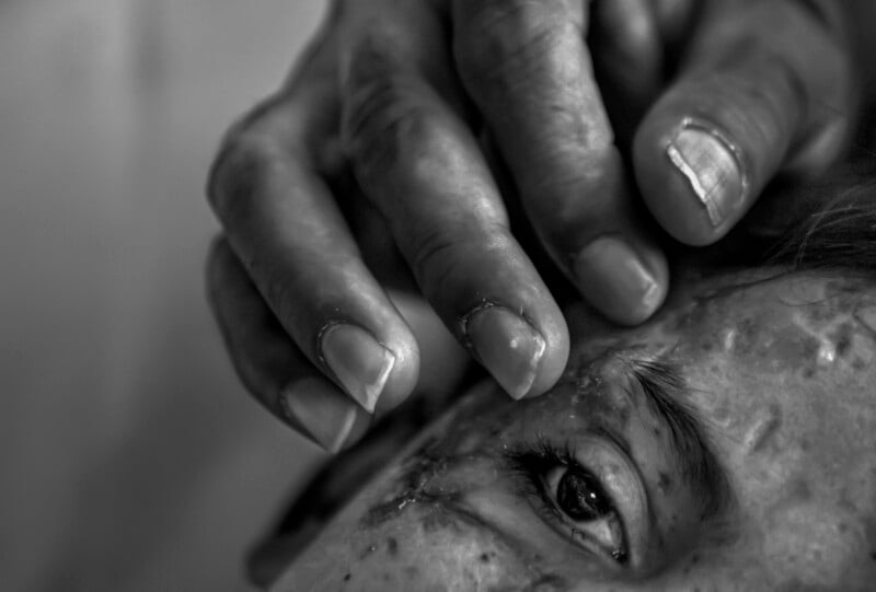 A close-up black and white image of a person looking upwards. An outstretched hand rests on their forehead. The lighting highlights the intense gaze of the eye.