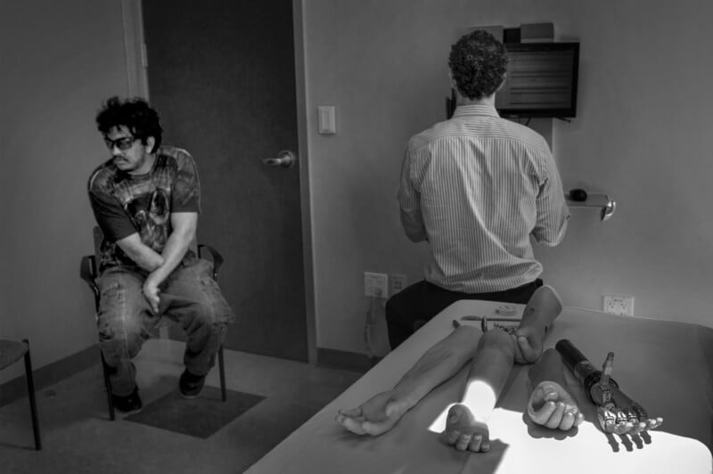 A man sits on a chair in a medical office, looking to the side. Another person, facing away, works at a computer. Prosthetic limbs are laid out on a nearby examination table. The room is lit with natural light.