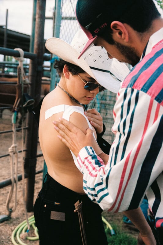 Two people at a rodeo setting. One person, wearing a white cowboy hat and sunglasses, has bandages on their shoulder. The other, in a striped shirt, is adjusting the bandages. Ropes and cattle pens are visible in the background.