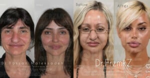 Plastic Surgeon Accused of Photoshopping Viral Transformation Photos of His Clients