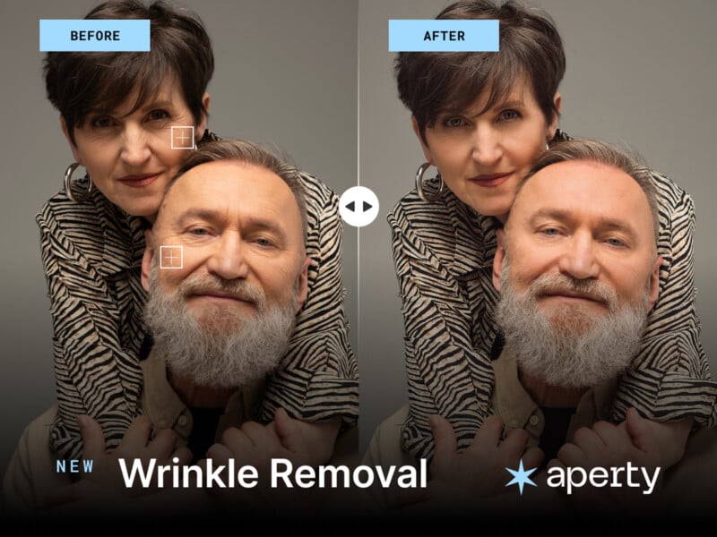 A before-and-after image of an older couple showing wrinkle removal. The "before" side has visible wrinkles, while the "after" side shows smoother skin. The text reads "NEW Wrinkle Removal" and "aperty" with a star logo.