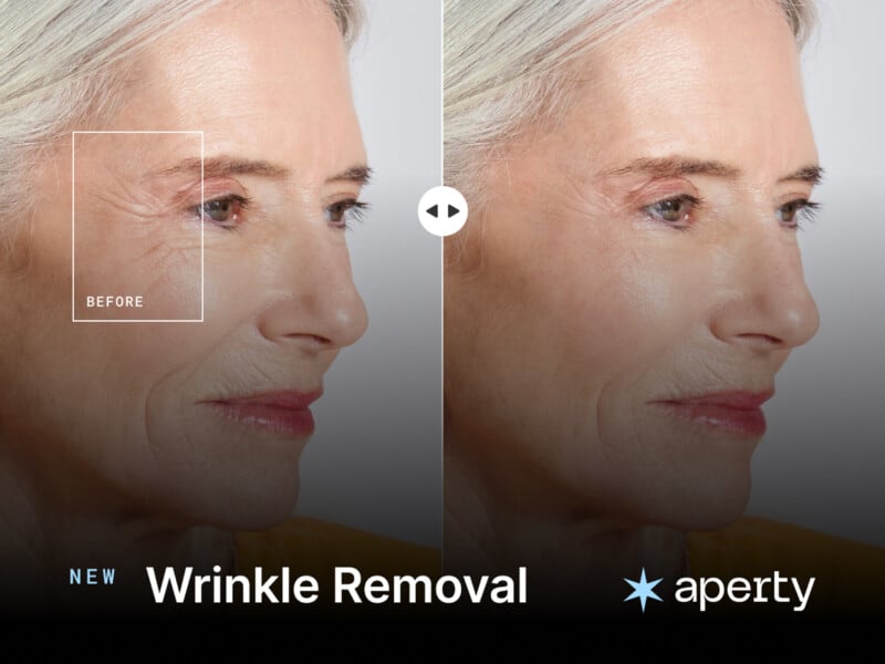 Split image showing the profile of a woman's face before and after wrinkle removal. The left side, marked "Before," displays more pronounced wrinkles around the eye, while the right side shows a smoother complexion. Text reads "New Wrinkle Removal, aperty.