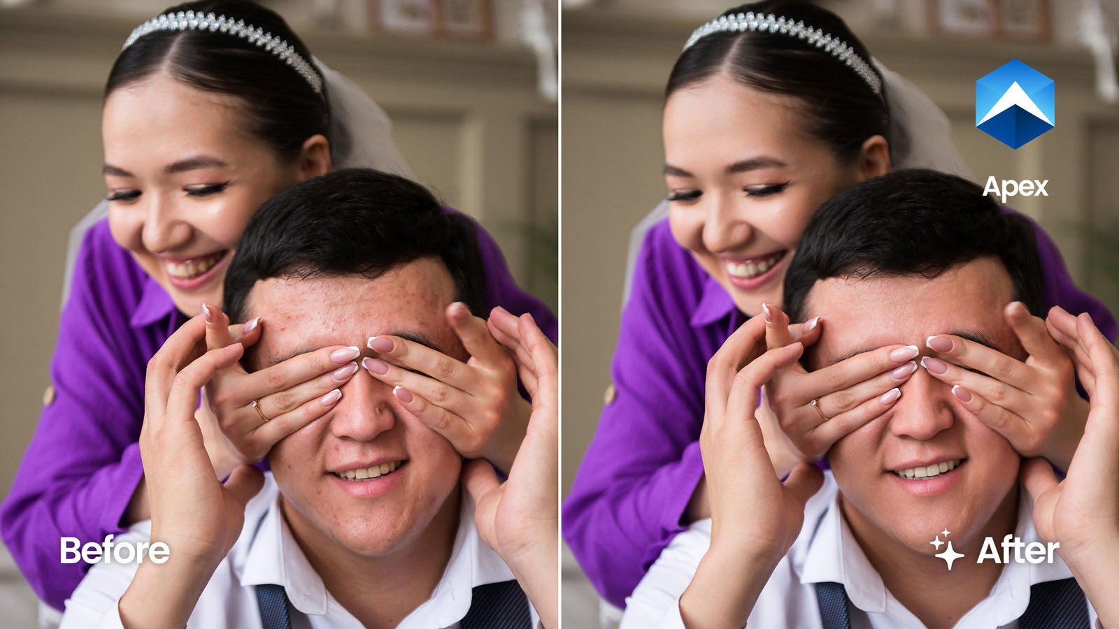 A smiling woman playfully covers a man's eyes from behind in both images. The left side is labeled "Before" with more visible skin blemishes, while the right, labeled "After," shows smoother skin and enhanced clarity.