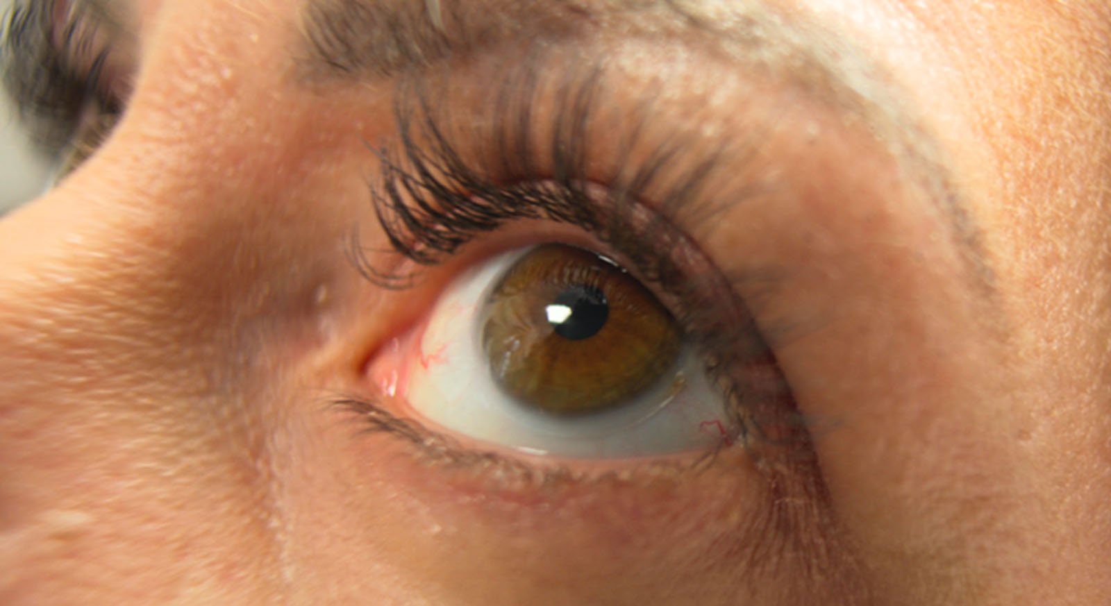 Close-up of a human eye looking upward, showing detailed brown iris, long eyelashes, and textured skin around the eye.