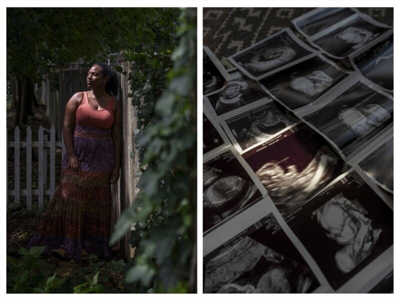A woman in a long skirt stands by a wooden fence in a leafy garden. Next to her, several ultrasound images are spread out on a patterned surface, one highlighted by a beam of light.