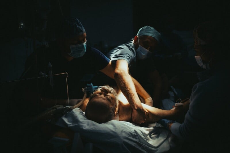 Three medical professionals wearing masks and gowns attend to a patient lying in a hospital bed under dramatic lighting, focusing on the patient's exposed chest and arm during a procedure or examination.