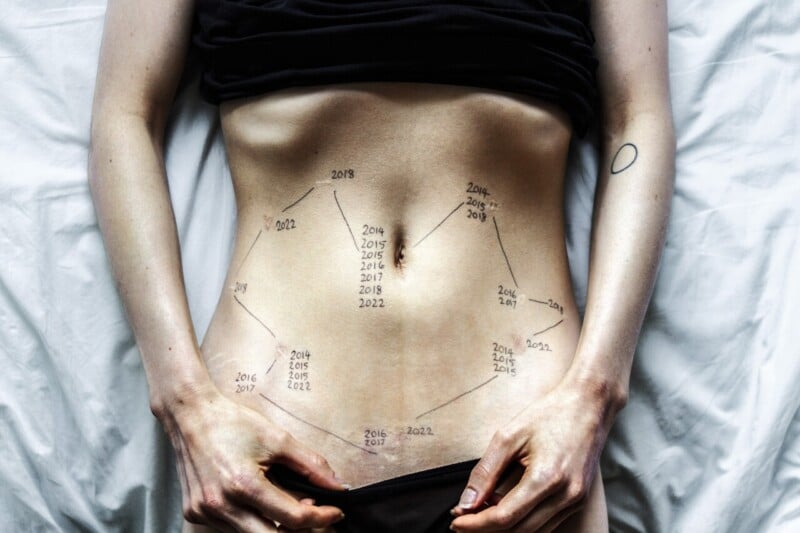 A person lying on a bed with their shirt pulled up, exposing their stomach. Years from 2014 to 2022 are written in a pattern across their skin, and one hand is pulling down the waistband of their underwear.