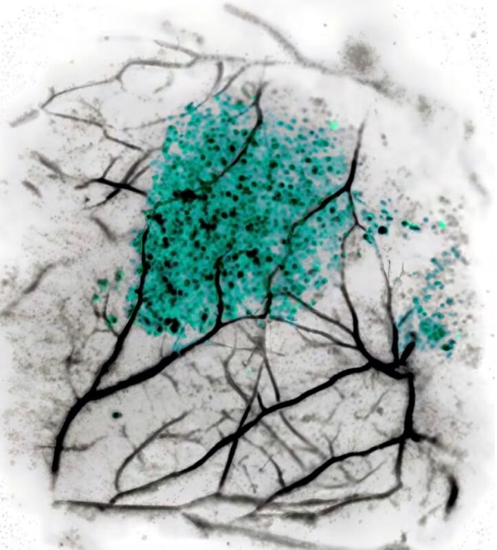 Microscopic image showing a cluster of turquoise cells surrounded by branching, black lines resembling neural or vascular structures on a white background.