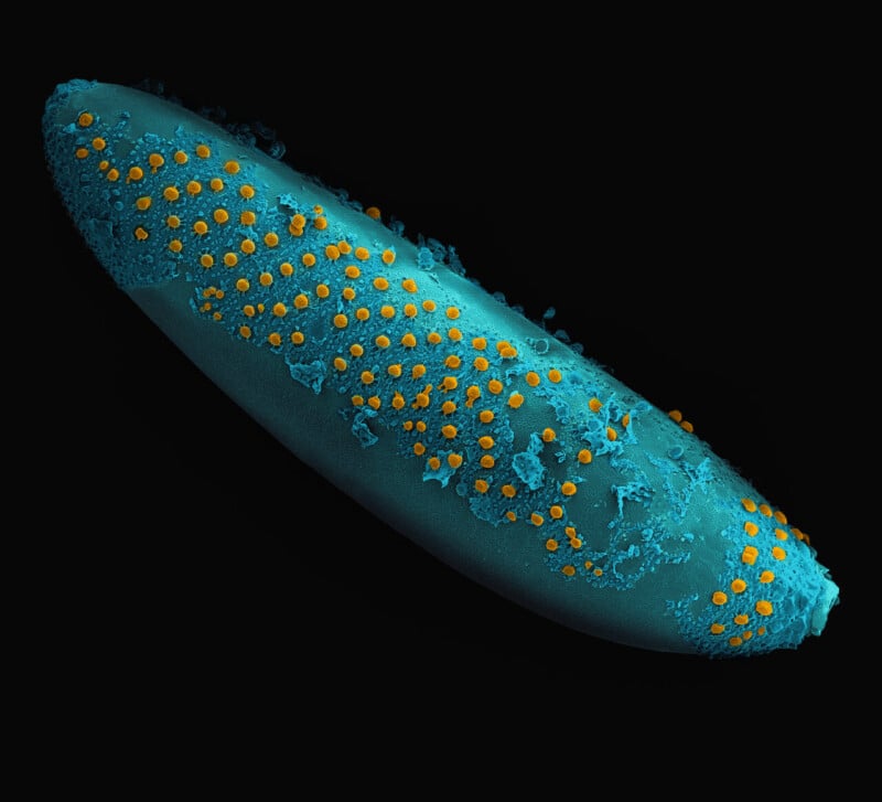 A magnified image of a blue, oval-shaped cell with clusters of small, bright orange-yellow dots scattered across its surface, set against a black background.