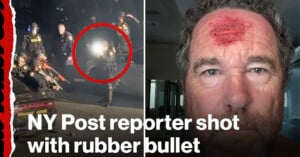 A police officer aims a weapon with a flash of light at night; inset shows a man with a bleeding forehead wound. Text reads: "NY Post reporter shot with rubber bullet.