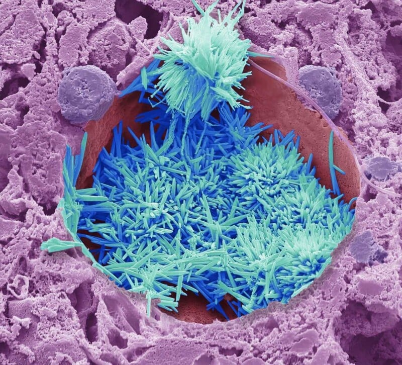 Colorized microscopic image showing needle-like blue and teal crystals growing inside a round, crater-like purple and pink surface, representing a close-up view of mineral or crystal formation.