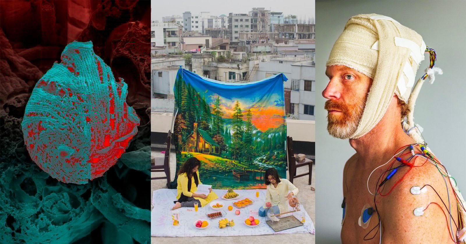 A collage: Left, a microscope image of a textured spherical object; center, two people having a picnic on a rooftop with city buildings and a scenic backdrop; right, a man with medical electrodes and bandages on his head and arm.