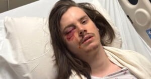 A man with long hair lies in a hospital bed with a visibly swollen, bruised, and bloody left eye. He looks tired and is covered with a white blanket, wearing a hospital gown.