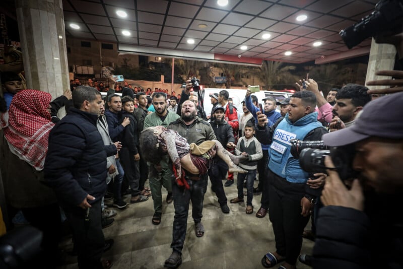 A man carries an injured child through a crowded emergency area as people, including press and photographers, look on. The scene is tense, with many expressions of concern and urgency.