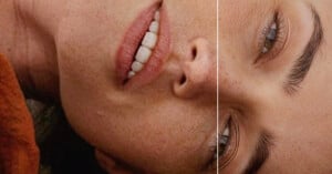 A split image showing two close-up views of faces lying sideways, focusing on natural lips, teeth, and eyes with visible skin texture and freckles.