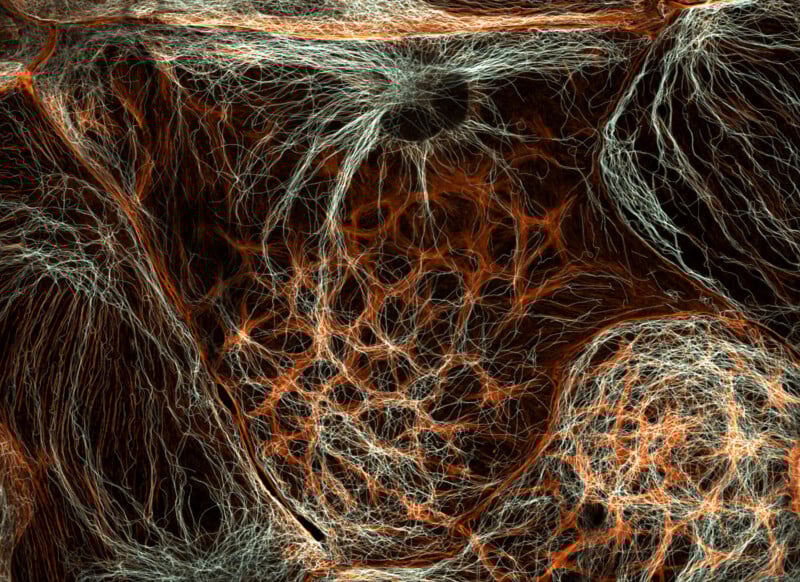Vista microscópica de una intrincada red de fibras naranjas y blancas que forman patrones orgánicos complejos sobre un fondo oscuro. La imagen se asemeja a una célula o red neuronal interconectada.