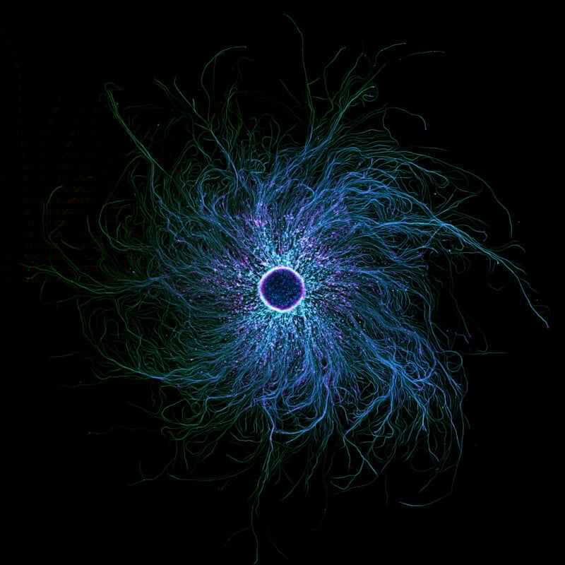Formas redondas azules y violetas brillantes con finas líneas radiantes sobre fondo negro, que se asemejan a vías neuronales o ráfagas abstractas de energía.