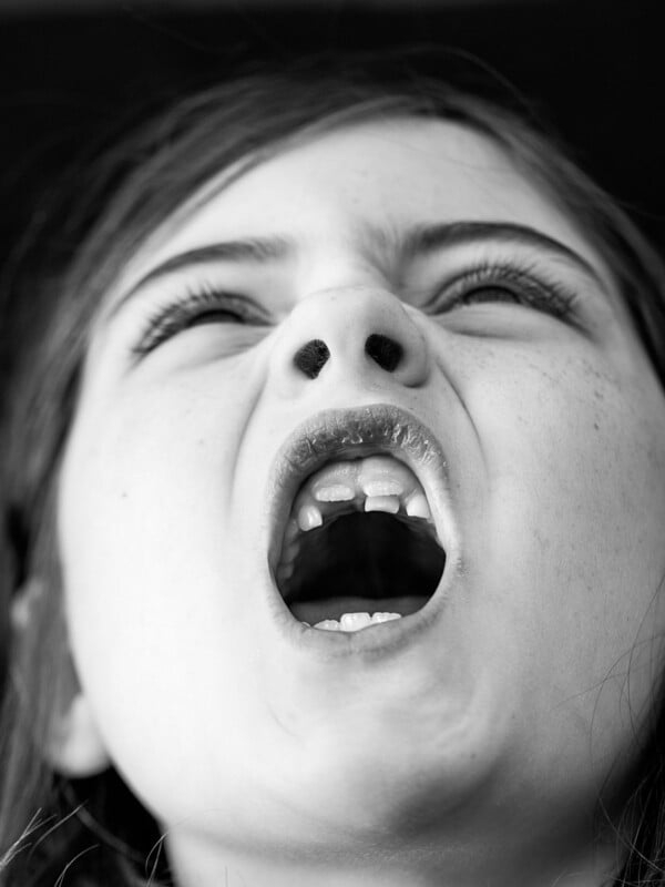 A close-up, black and white photo of a child with their mouth wide open, showing missing front teeth and an expressive face, possibly shouting or yawning.
