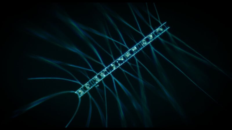 Close-up microscopic image of a thin, segmented, glowing blue-green filamentous microorganism against a dark background, with radiating thread-like structures.