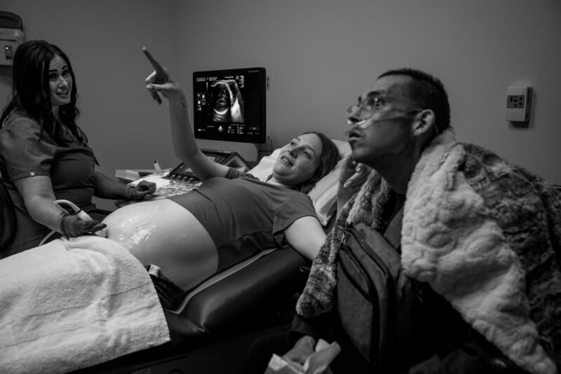 A pregnant woman lies on an exam table during an ultrasound, smiling and pointing, with a partner sitting nearby and a technician operating the machine. The atmosphere appears joyful and expectant.