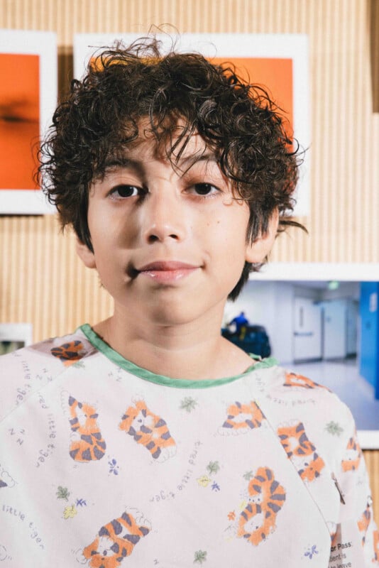 A young child with curly hair wearing a hospital gown stands indoors, with colorful photographs and a wooden wall in the background. The child gazes calmly at the camera.