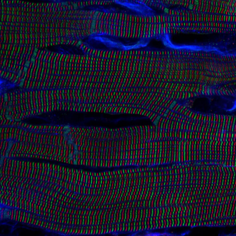Microscopic view of muscle tissue displaying parallel, wavy lines in red, green, and blue with irregular, dark horizontal gaps and blue highlights, illustrating the striated pattern of muscle fibers.