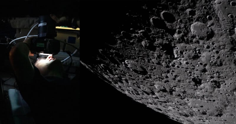 A person uses medical equipment in a dimly lit setting on the left, while the right side shows a detailed, cratered surface of the Moon.