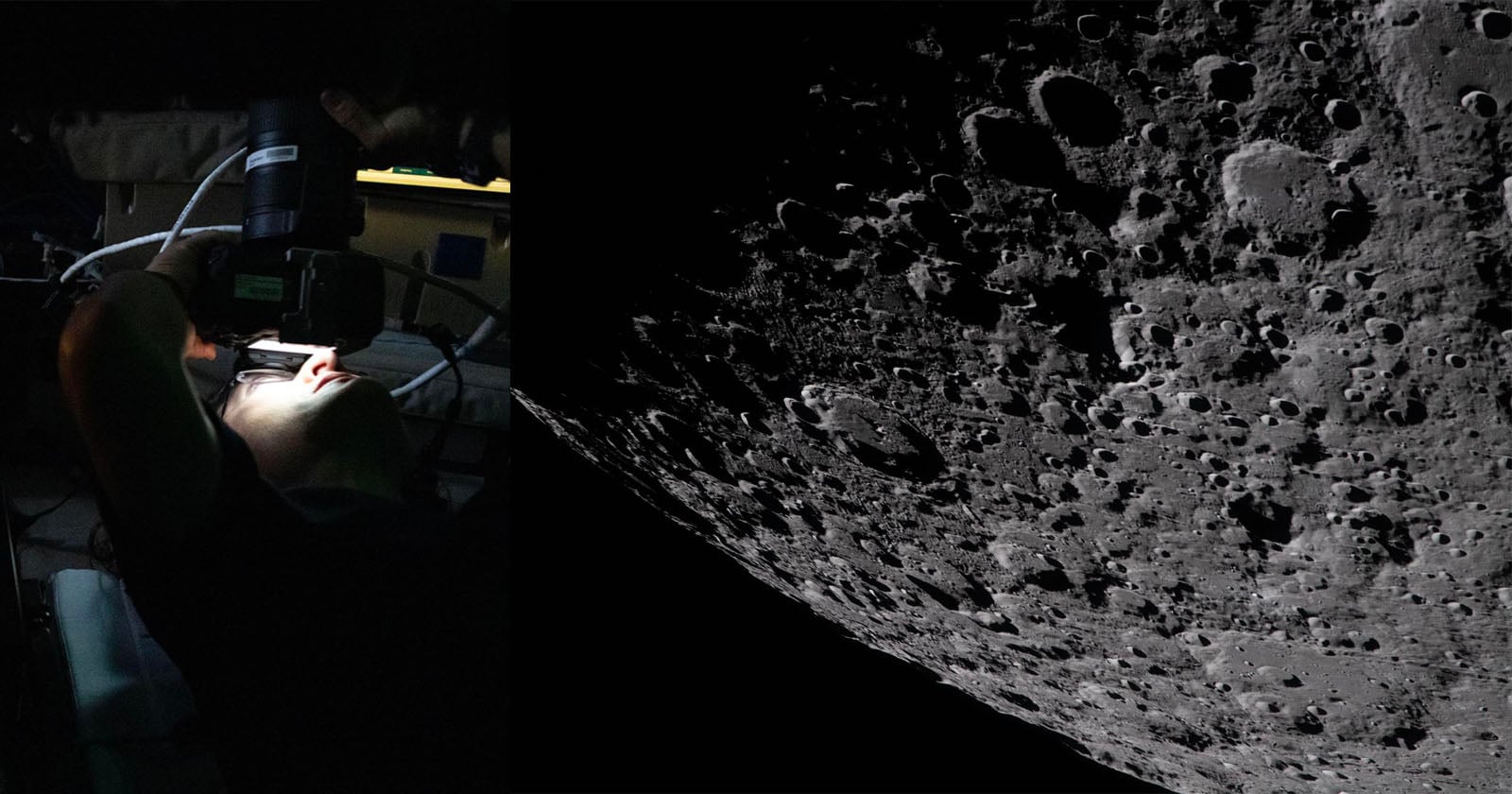 A person uses medical equipment in a dimly lit setting on the left, while the right side shows a detailed, cratered surface of the Moon.