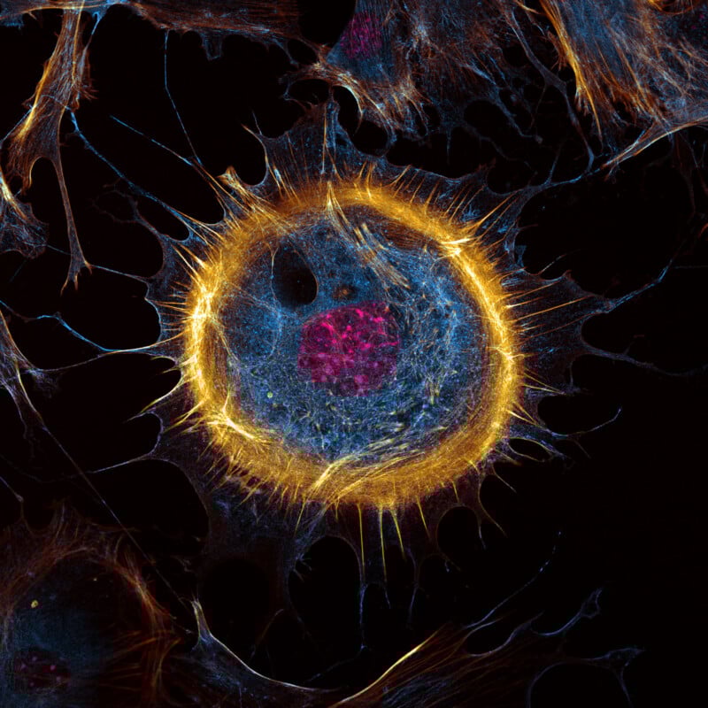 Colorful microscopic image of a cell with a bright yellow circular outline, a pink nucleus in the center, and blue filaments radiating outward on a dark background.