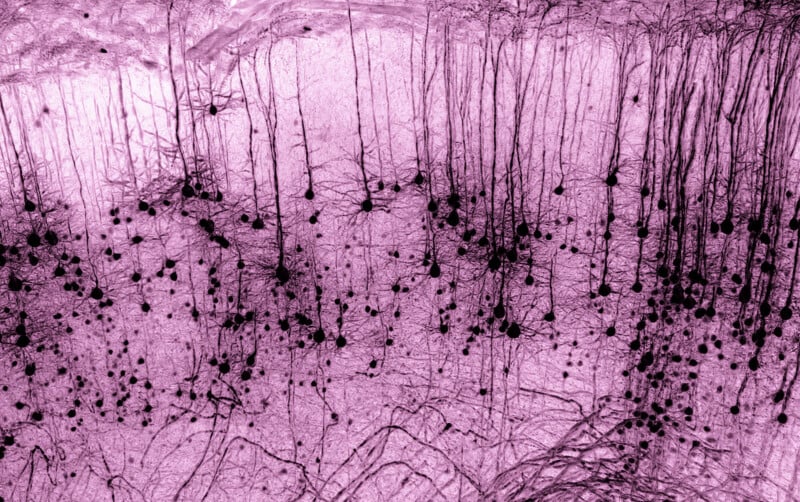 Black neurons with long, branching dendrites are visible against a pink background, highlighting the complex structure of neural cells. The image resembles a brain tissue section seen under a microscope.