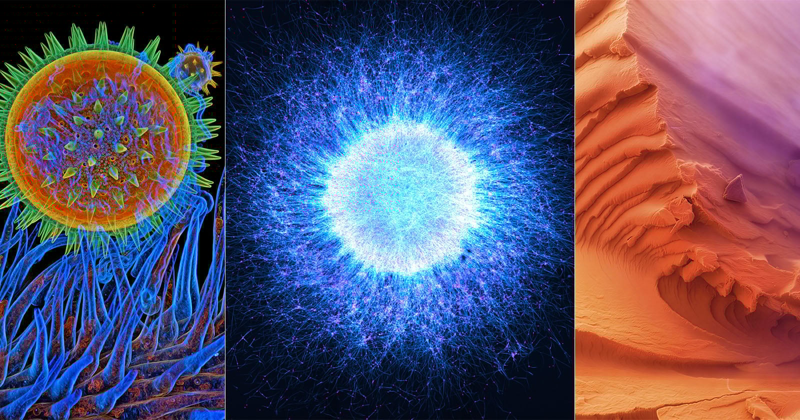 A collage of three microscopic images: a colorful cell with hair-like projections, a glowing blue spherical cluster with radiating lines, and a textured orange and purple layered surface.