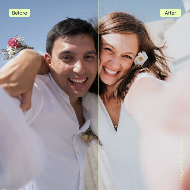 A joyful couple smiles closely at the camera, holding each other outdoors. The woman wears a white dress and the man is in a white shirt. Sunlight brightens their faces. “Before” is labeled left; photo credit on the right.