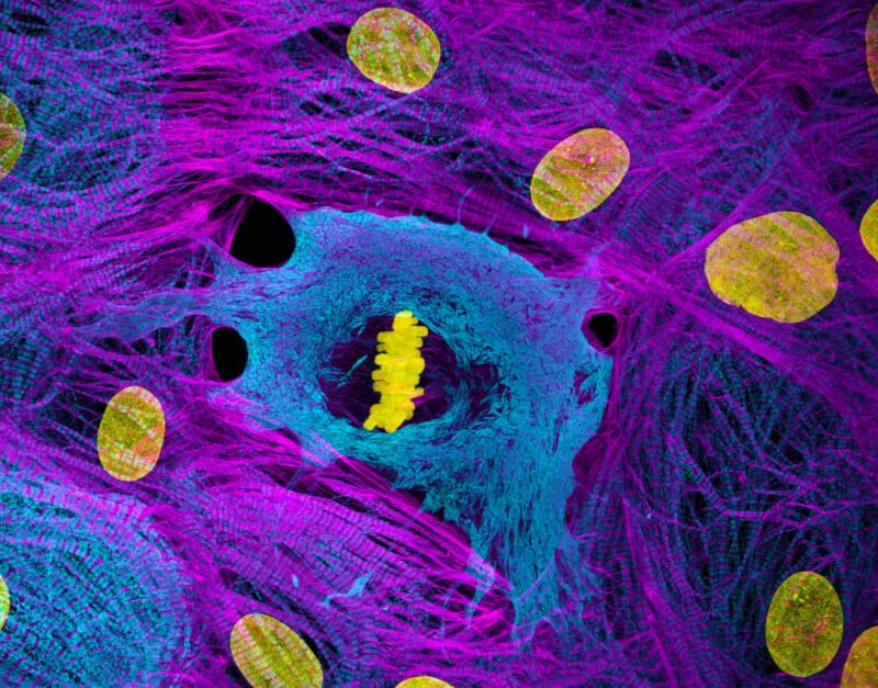 A fluorescence microscopy image shows a cell in the process of division, with yellow chromosomes aligned in the center, surrounded by a blue cytoskeleton and purple muscle fibers, against a background of other cell nuclei.