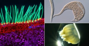 A composite image showing a fluorescent microscopic view of cilia, a single-celled organism, and a small jellyfish in a droplet.