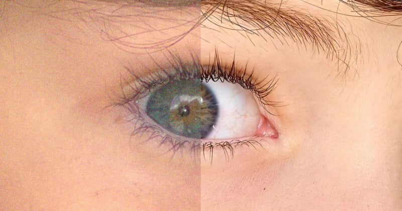 A split-screen comparison showing a grainy, low-resolution eye on the left and a clear, high-resolution eye on the right.