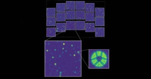 A composite image showing a grid of 20 small, dark-field microscopy panels, with one panel magnified to reveal individual circular structures containing geometric patterns.