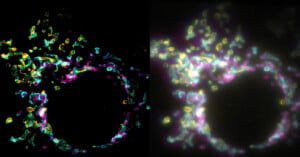 A side-by-side comparison of a cellular structure, showing a sharp, high-contrast fluorescence image on the left and a blurred, glowing version on the right.