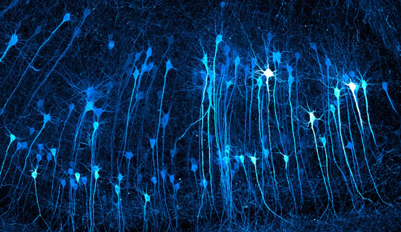 A fluorescence microscopy image showing a dense cluster of blue-glowing neurons with long, branching axons extending downward.