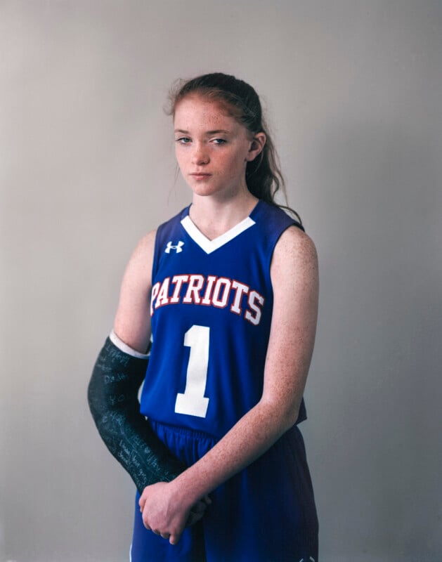 A young girl with freckles and long reddish-brown hair wears a blue basketball jersey with the word "PATRIOTS" and the number "1" on it, with her right arm in a black cast.