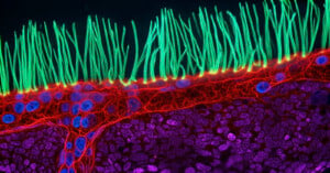 A fluorescence microscopy image shows a layer of cells with long, green, hair-like cilia extending from their surface.