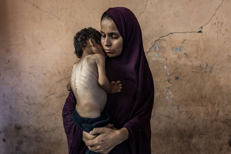 A woman wearing a dark purple hijab holds a severely malnourished child against her chest in front of a plain, textured wall.