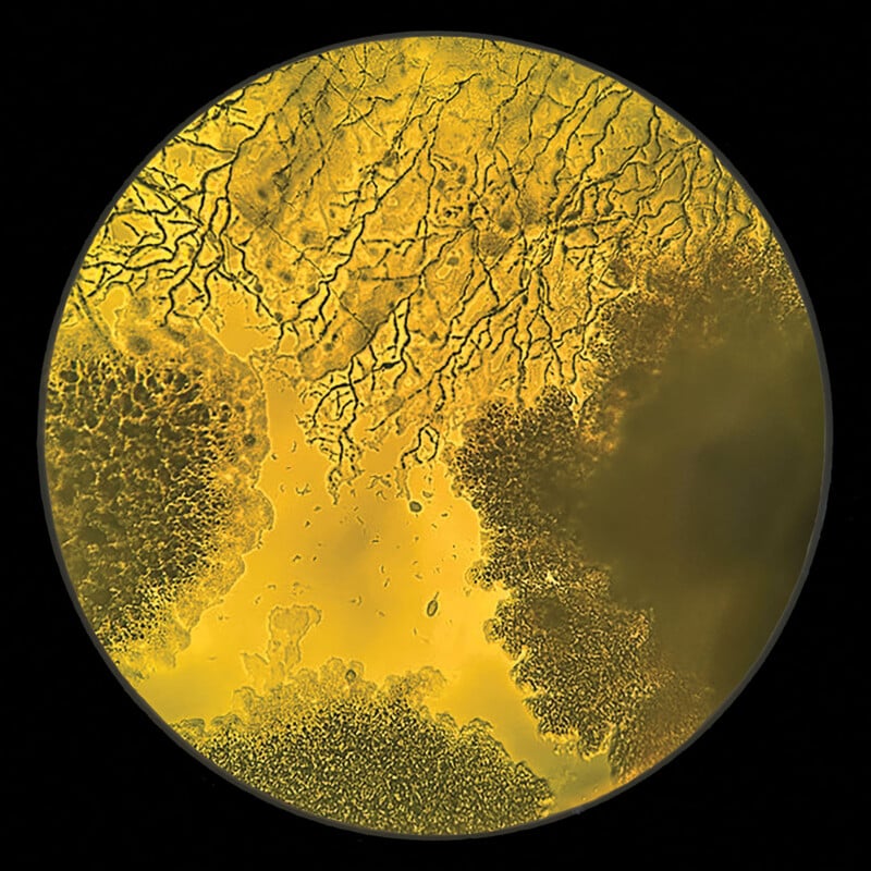 A circular microscopic view shows a yellow, textured substance with branching, vein-like patterns and dense, granular clusters.