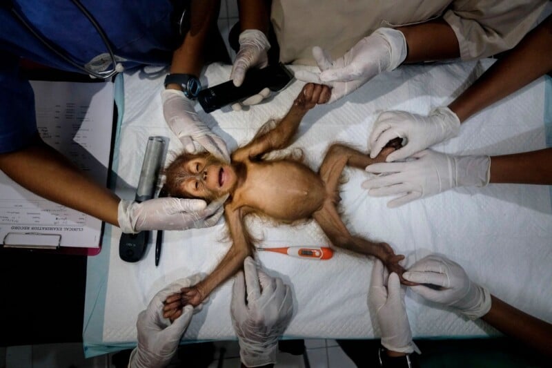 A young orangutan lies on a medical examination table surrounded by several pairs of gloved hands, a thermometer, and medical tools.
