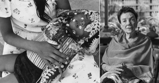 A split-screen image showing a person holding a child with white spots on their face on the left, and an older woman sitting with her hands clasped on the right.